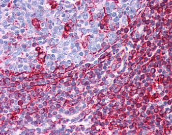 VIM Rabbit Polyclonal Antibody