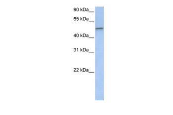VIM Rabbit Polyclonal Antibody
