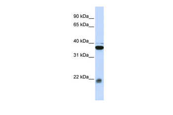 MYL9 Rabbit Polyclonal Antibody