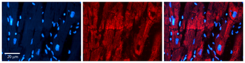 PHB2 Rabbit Polyclonal Antibody