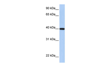RDH11 Rabbit Polyclonal Antibody
