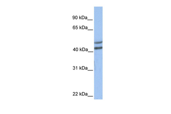 GALT Rabbit Polyclonal Antibody