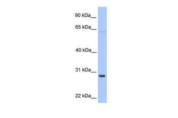 HPRT1 Rabbit Polyclonal Antibody