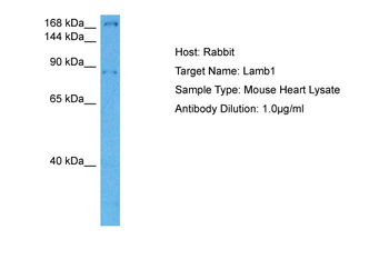 LAMB1 Rabbit Polyclonal Antibody