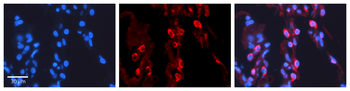 PAPSS2 Rabbit Polyclonal Antibody