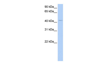 PECI Rabbit Polyclonal Antibody
