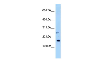 Nudt15 Rabbit Polyclonal Antibody