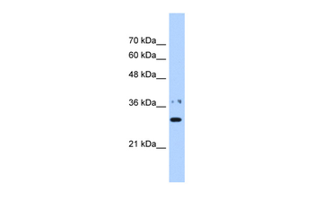 NMNAT1 Rabbit Polyclonal Antibody