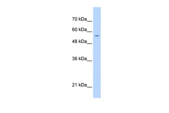 PGS1 Rabbit Polyclonal Antibody