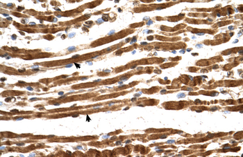 NARG1L Rabbit Polyclonal Antibody