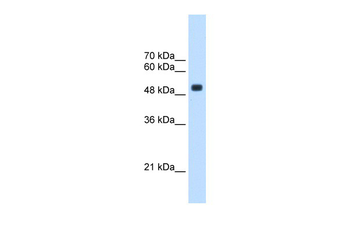 CXorf34 Rabbit Polyclonal Antibody