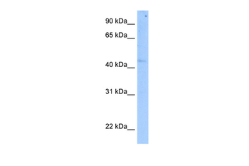 SETD7 Rabbit Polyclonal Antibody
