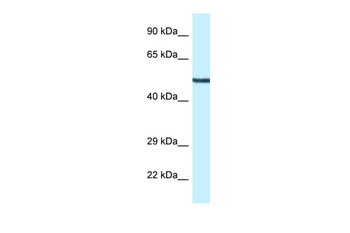 Map2k5 Rabbit Polyclonal Antibody