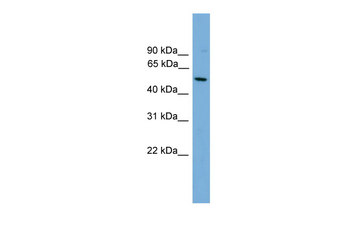 HLA-F Rabbit Polyclonal Antibody
