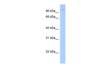 LRRC8A Rabbit Polyclonal Antibody