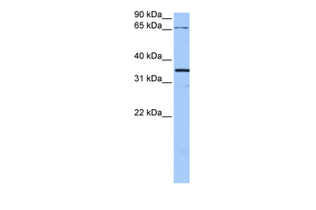 NLGN4X Rabbit Polyclonal Antibody