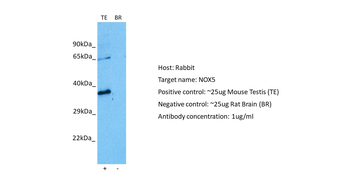 NOX5 Rabbit Polyclonal Antibody
