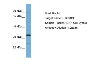C12orf49 Rabbit Polyclonal Antibody