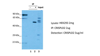 CRISPLD2 Rabbit Polyclonal Antibody