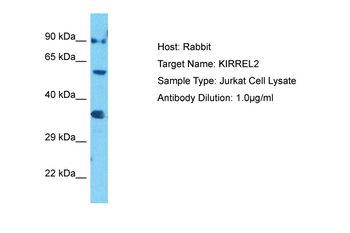 KIRREL2 Rabbit Polyclonal Antibody