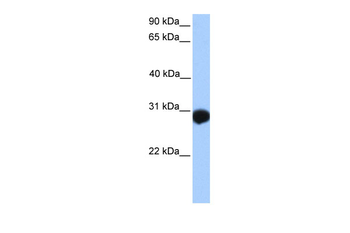 SLAMF6 Rabbit Polyclonal Antibody
