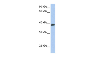 AQP10 Rabbit Polyclonal Antibody