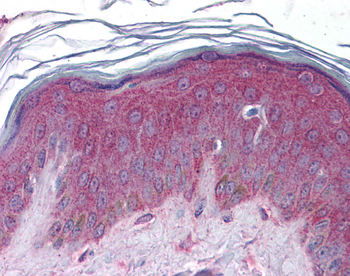APC2 Rabbit Polyclonal Antibody