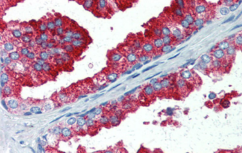 YAP1 Rabbit Polyclonal Antibody