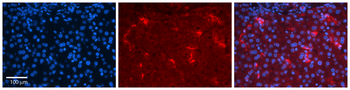 YBX1 Rabbit Polyclonal Antibody