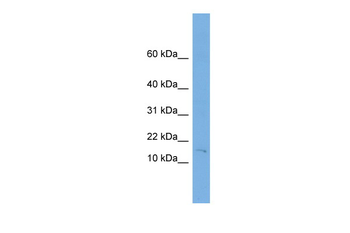 FHIT Rabbit Polyclonal Antibody