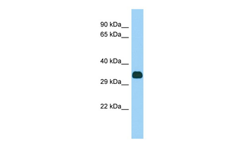 Fank1 Rabbit Polyclonal Antibody