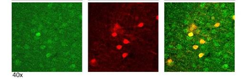 NTRK2 Rabbit Polyclonal Antibody