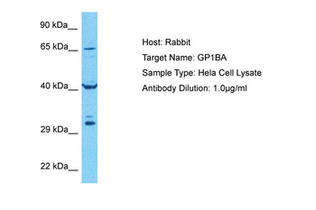 GP1BA Rabbit Polyclonal Antibody