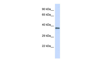 GP1BA Rabbit Polyclonal Antibody