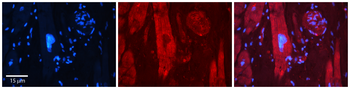 MAP1LC3A Rabbit Polyclonal Antibody