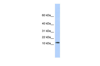 MAP1LC3A Rabbit Polyclonal Antibody