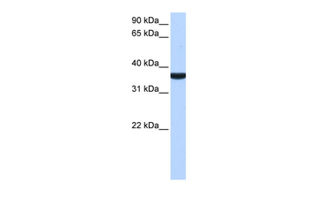 TP53I13 Rabbit Polyclonal Antibody