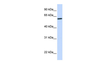CYP27A1 Rabbit Polyclonal Antibody