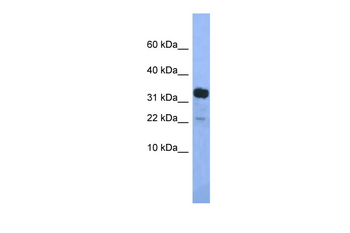Klhdc9 Rabbit Polyclonal Antibody