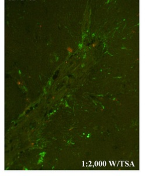CHI3L1 Rabbit Polyclonal Antibody