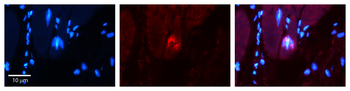 NET1 Rabbit Polyclonal Antibody