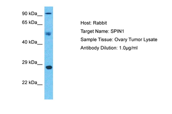 SPIN1 Rabbit Polyclonal Antibody