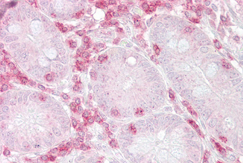 METAP2 Rabbit Polyclonal Antibody