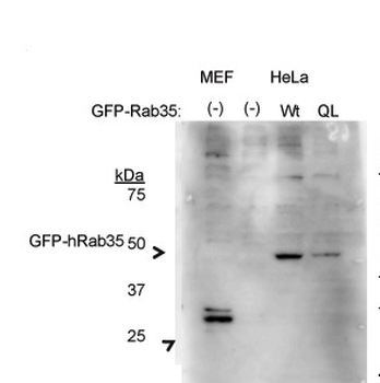 RAB35 Rabbit Polyclonal Antibody