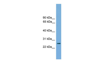 RAB35 Rabbit Polyclonal Antibody