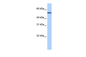 TOE1 Rabbit Polyclonal Antibody
