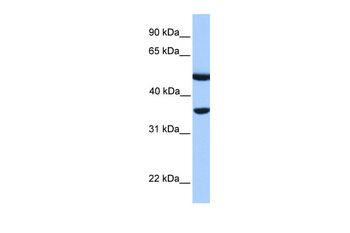 DNAJB6 Rabbit Polyclonal Antibody
