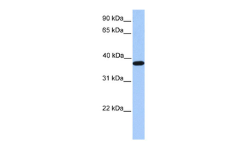 ACTRT2 Rabbit Polyclonal Antibody