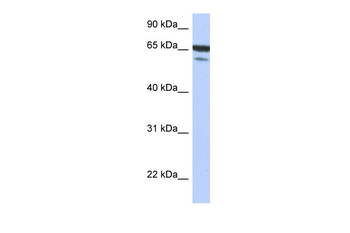 MAP3K7IP1 Rabbit Polyclonal Antibody