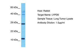 LYPD6 Rabbit Polyclonal Antibody